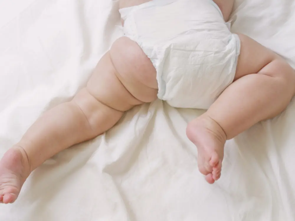 Tã, bỉm chật khiến bé bị hằn đỏ trên da